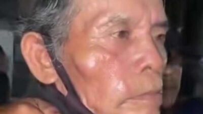 Alami Luka Lebam, Satpam Perum Griya Kencana Dianiaya