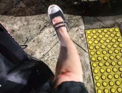 Pemotor Berjatuhan di Jalan Tole Iskandar Depok, Sanksi Pidana Penyelenggara Jalan