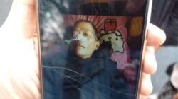 Akibat KIS BPI Non Aktif, Warga Baktijaya Alami Pengendapan Cairan di Otak